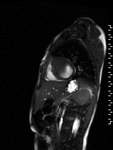 Radiograph 1 from archived case 107