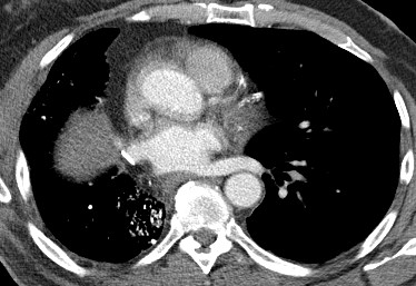 Radiograph 1 from archived case 228