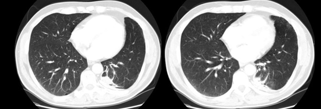 Radiograph 2 from archived case 1