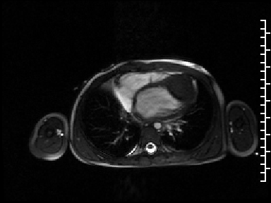 Radiograph 2 from archived case 107