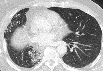 Radiograph 2 from archived case 228