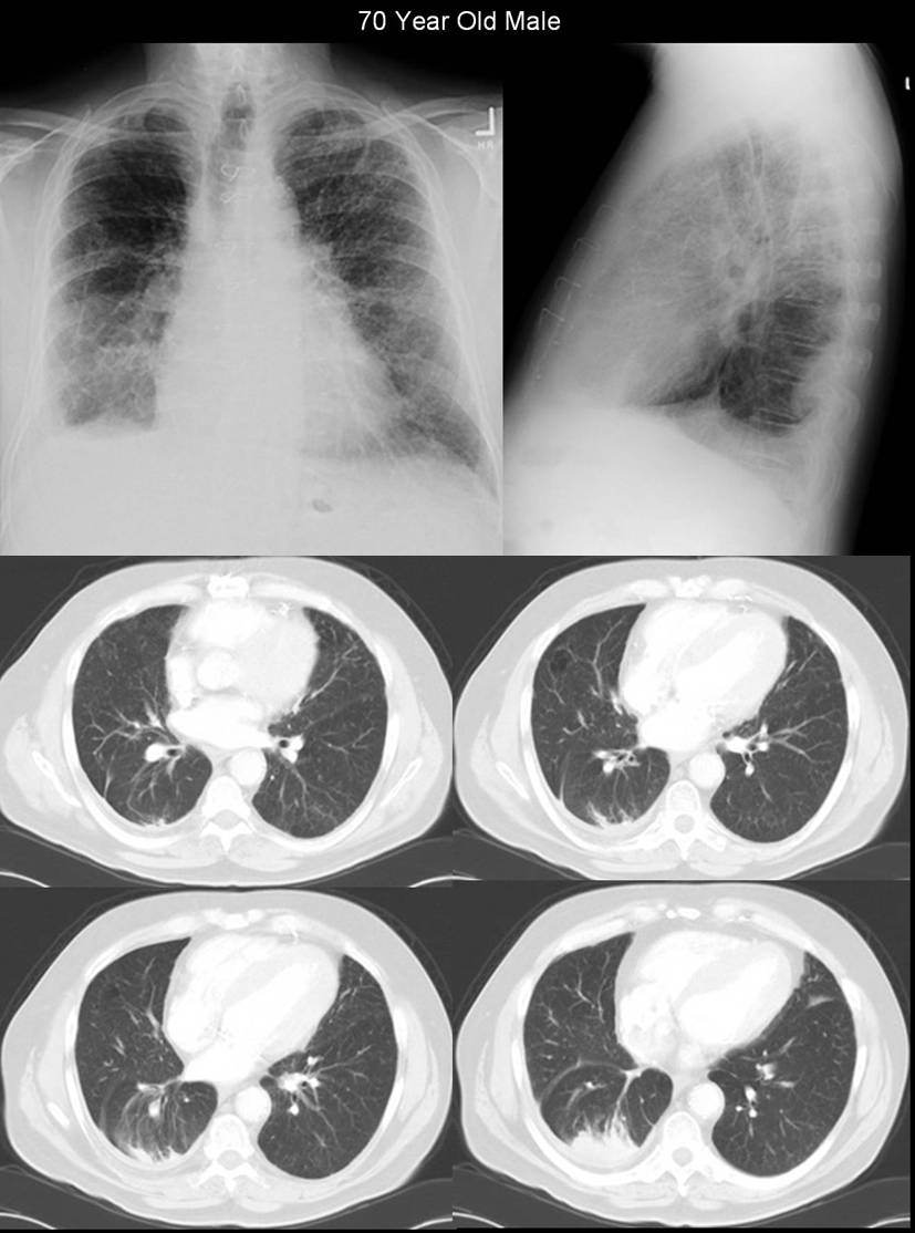 Radiograph 4 from archived case 1