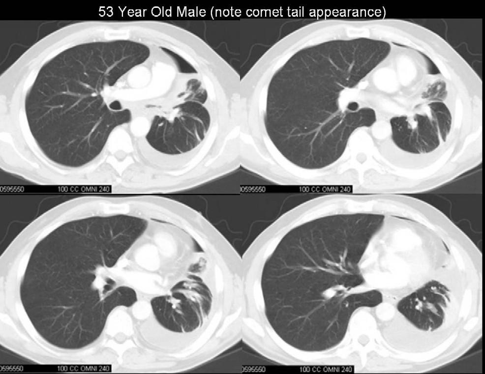 Radiograph 6 from archived case 1