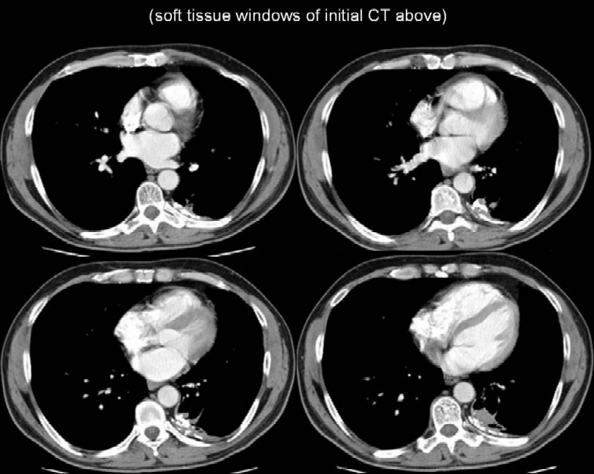 Radiograph 3 from archived case 1