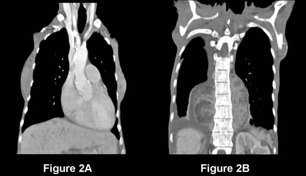 Radiograph 3 from archived case 78
