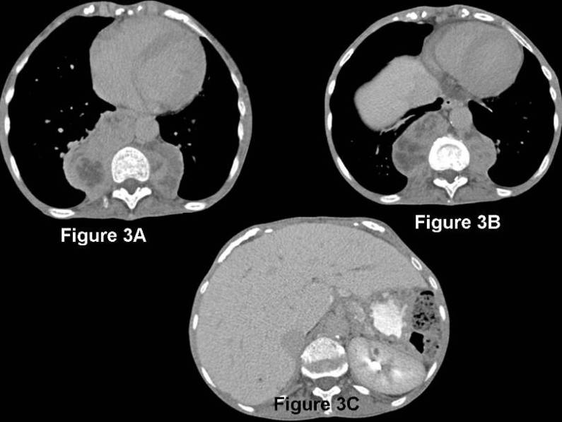 Radiograph 4 from archived case 78