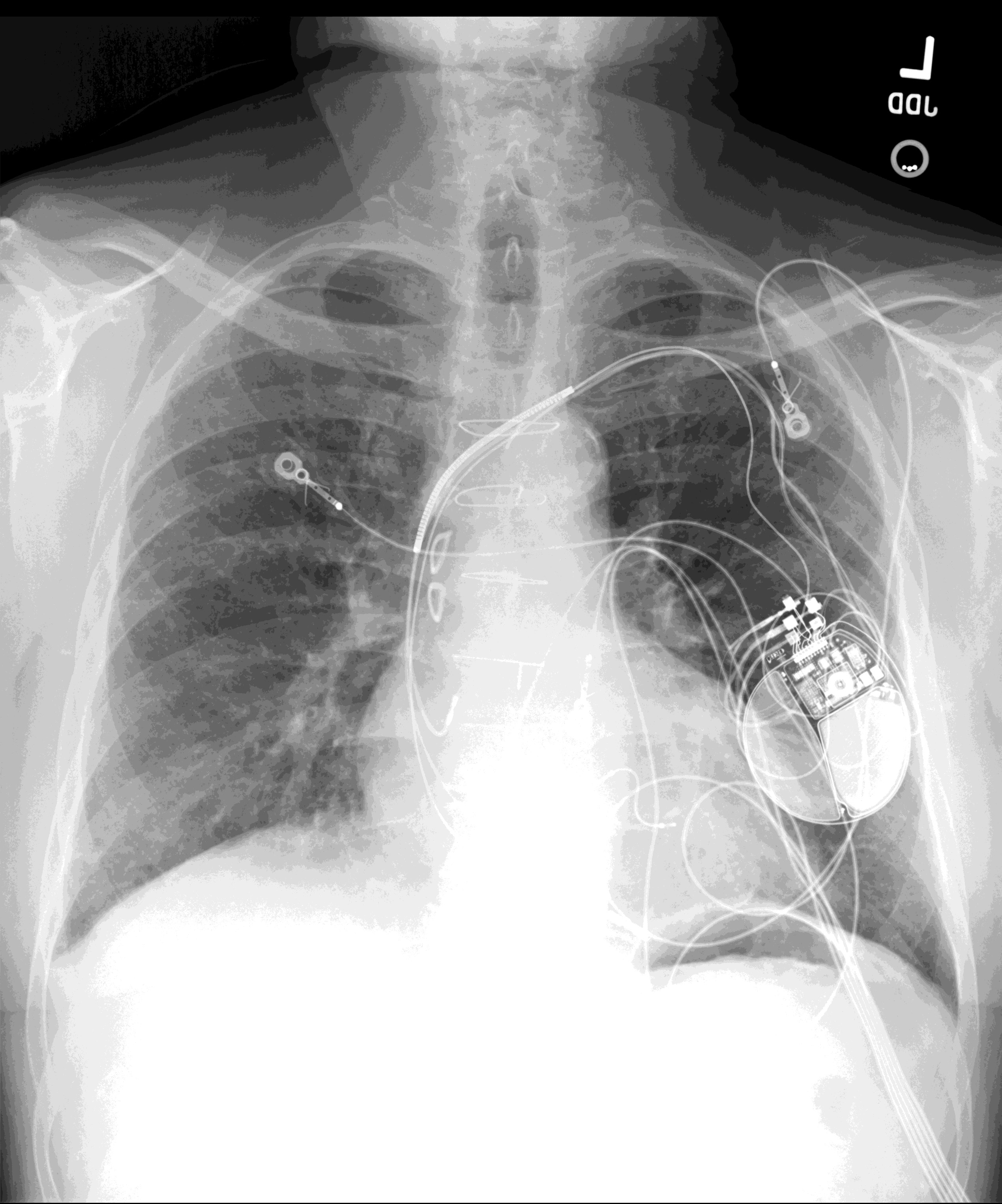 Radiograph 3 from archived case 215