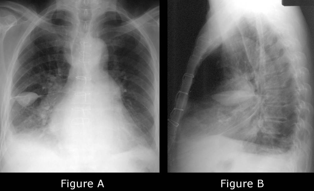 Radiograph 1 from archived case 60