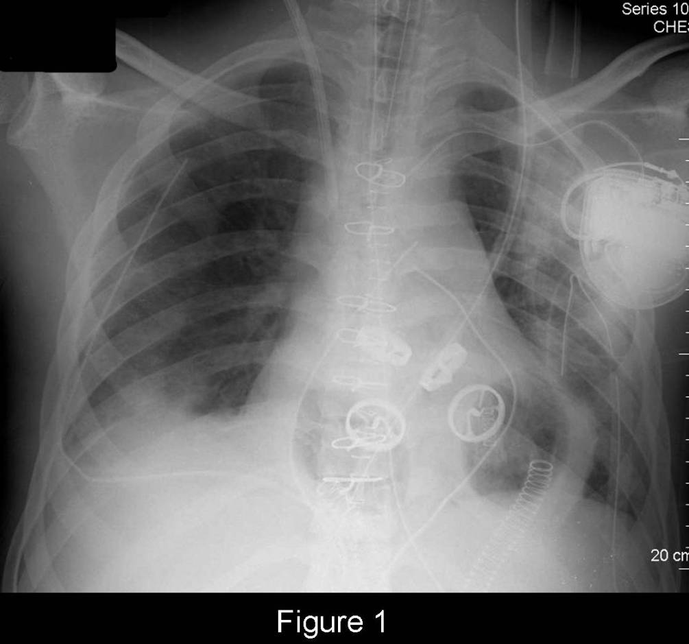Radiograph 1 from archived case 55