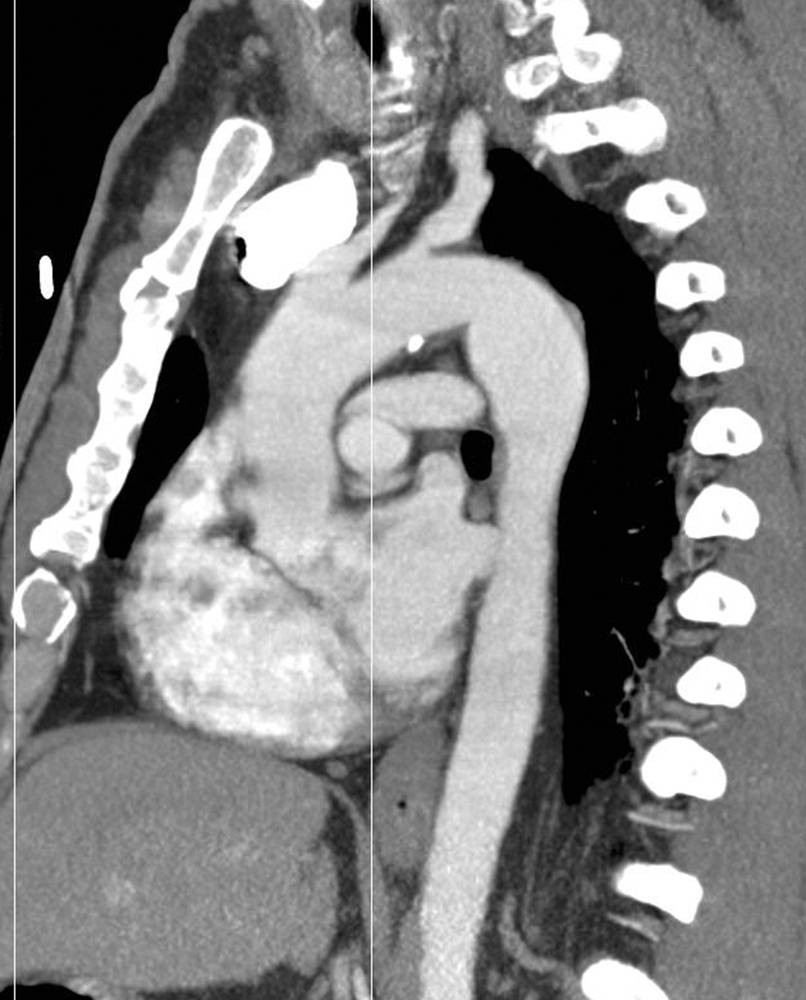 Radiograph 1 from archived case 17
