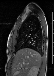 Radiograph 1 from archived case 72