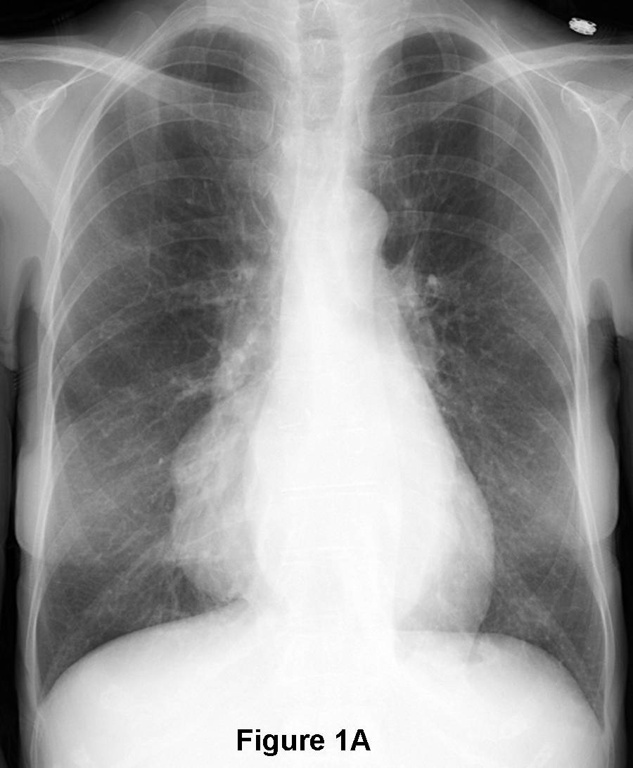 Radiograph 1 from archived case 78