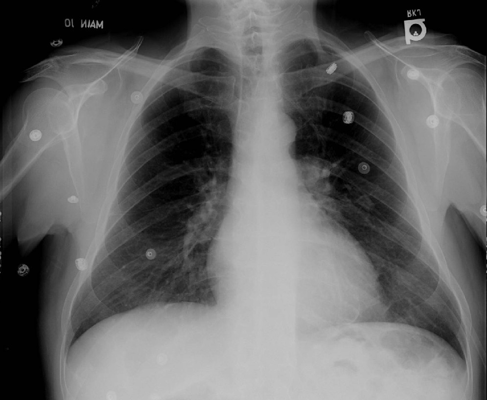 Radiograph 1 from archived case 10