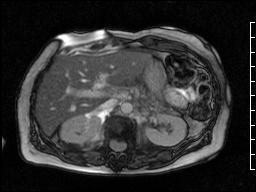 Radiograph 1 from archived case 61