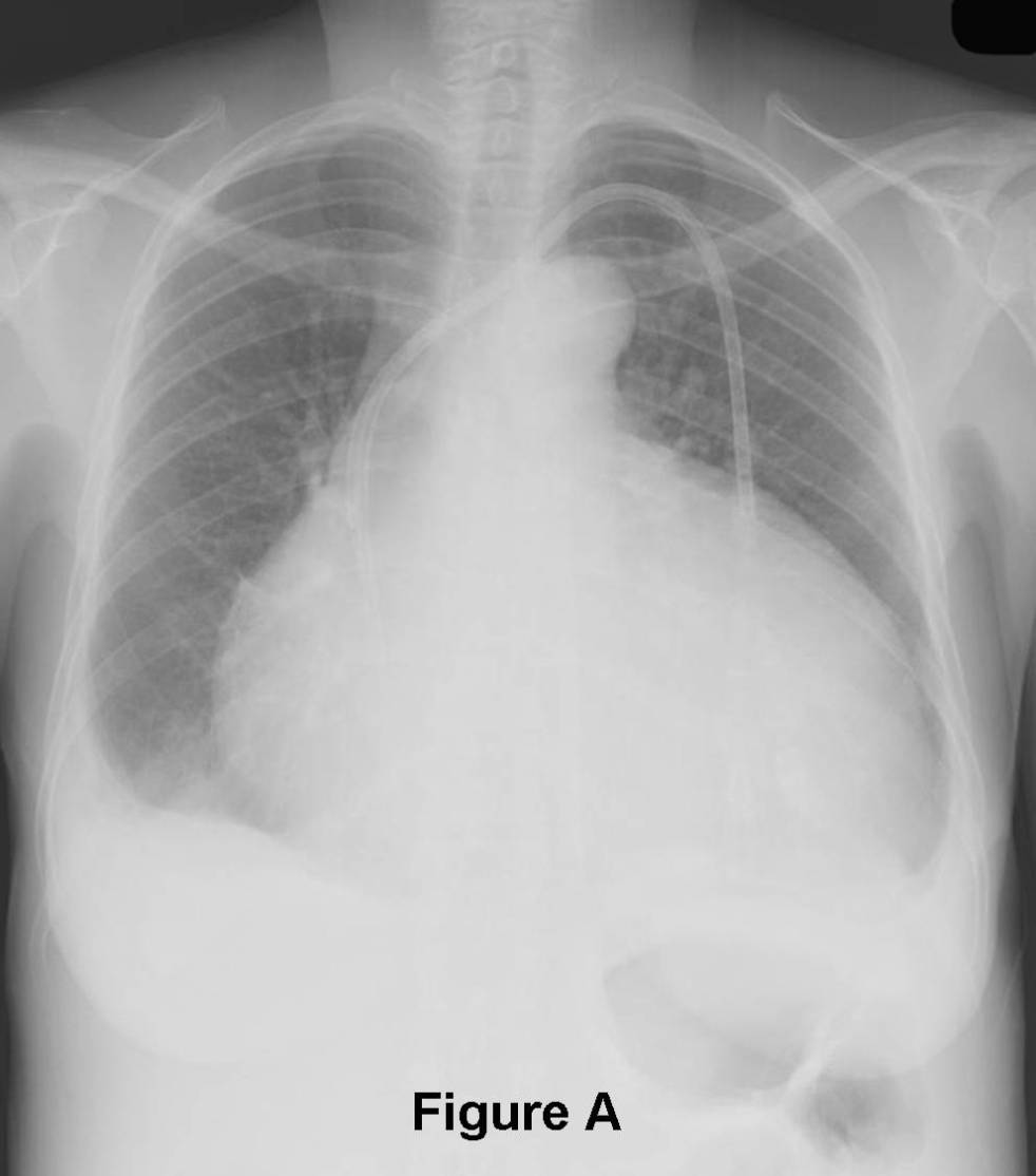 Radiograph 1 from archived case 52