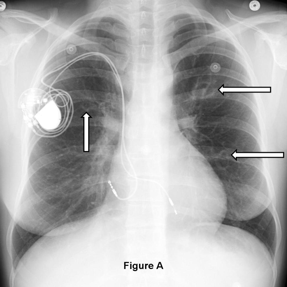 Radiograph 3 from archived case 59