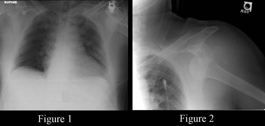 Radiograph 2 from archived case 65