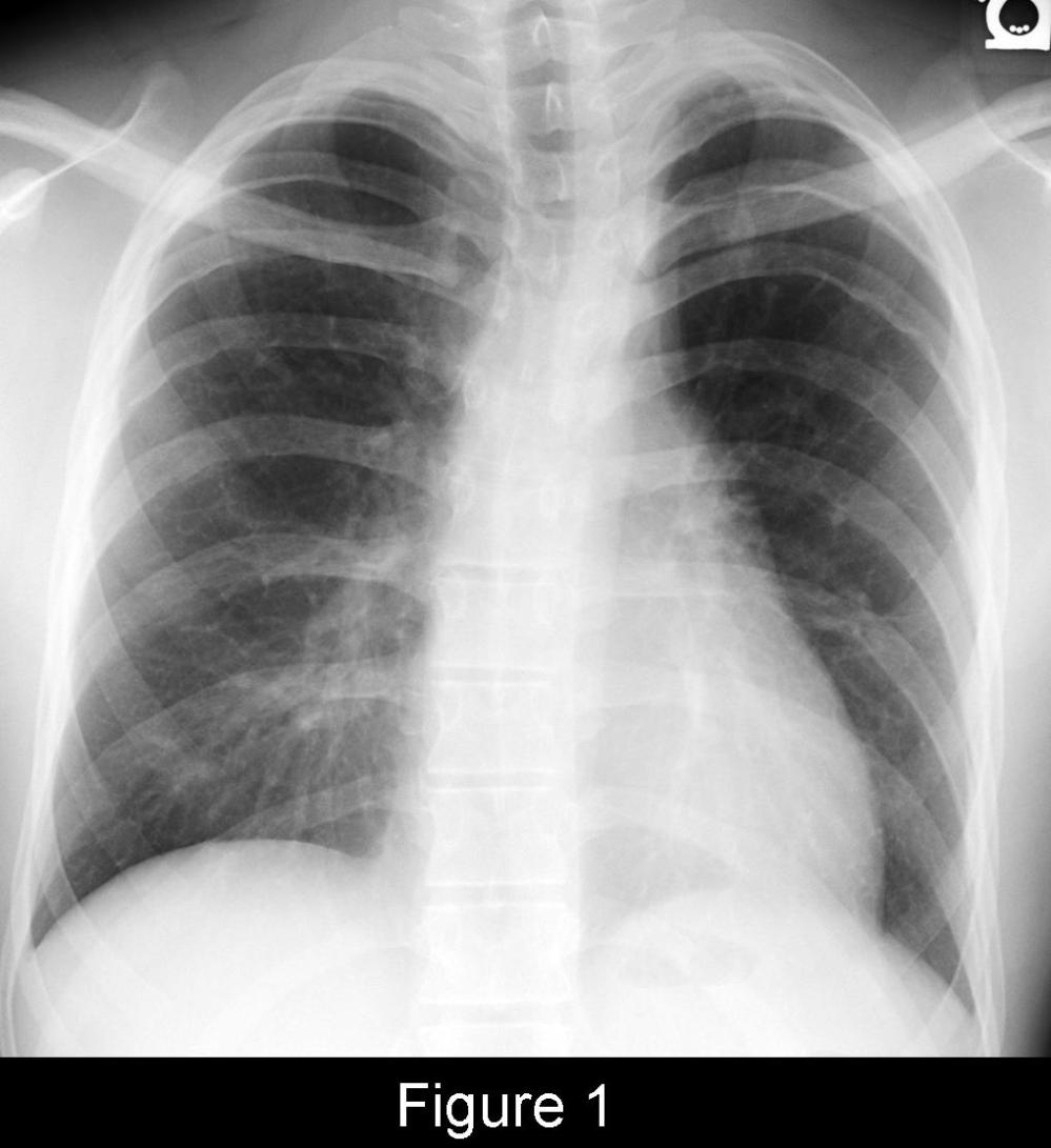 Radiograph 1 from archived case 57