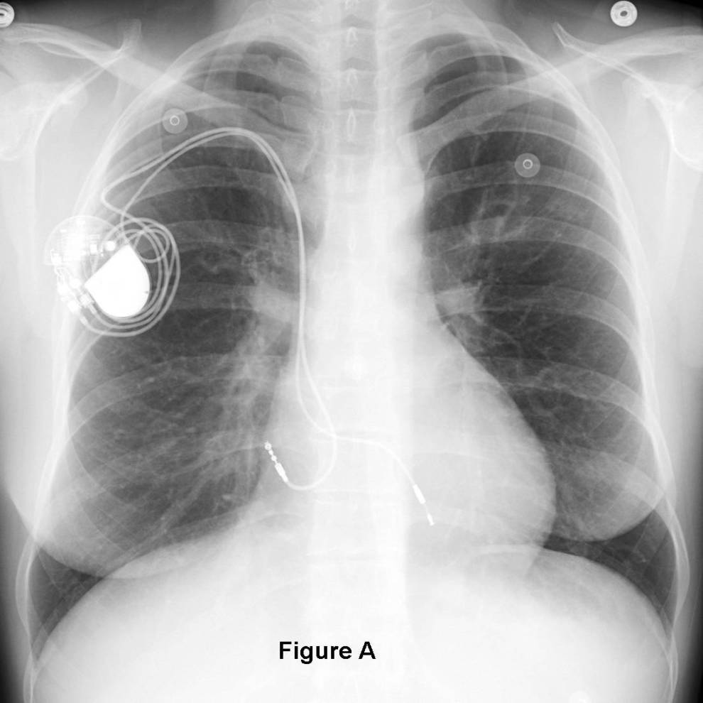 Radiograph 1 from archived case 59