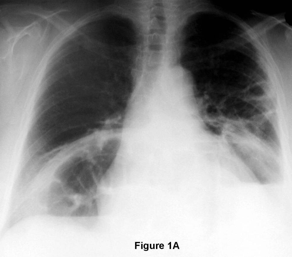 Radiograph 1 from archived case 76