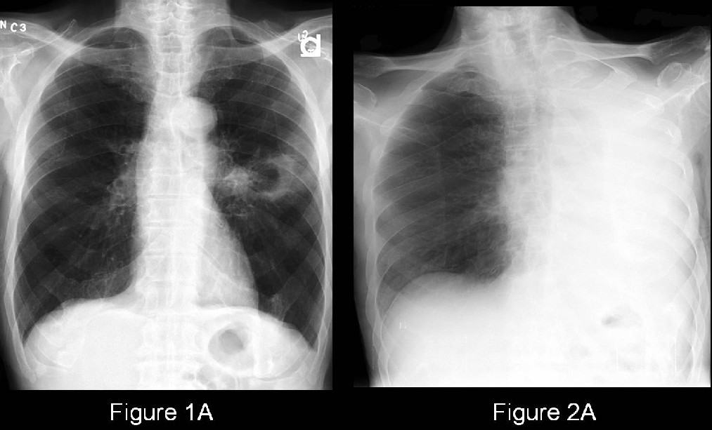 Radiograph 3 from archived case 35