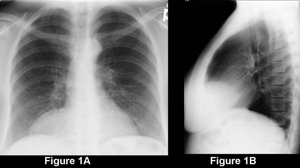 Radiograph 1 from archived case 67