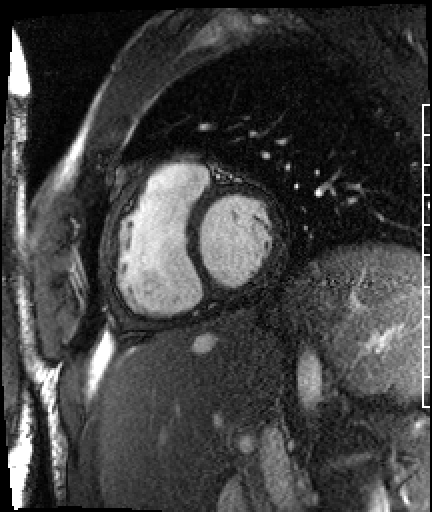 Radiograph 1 from archived case 38