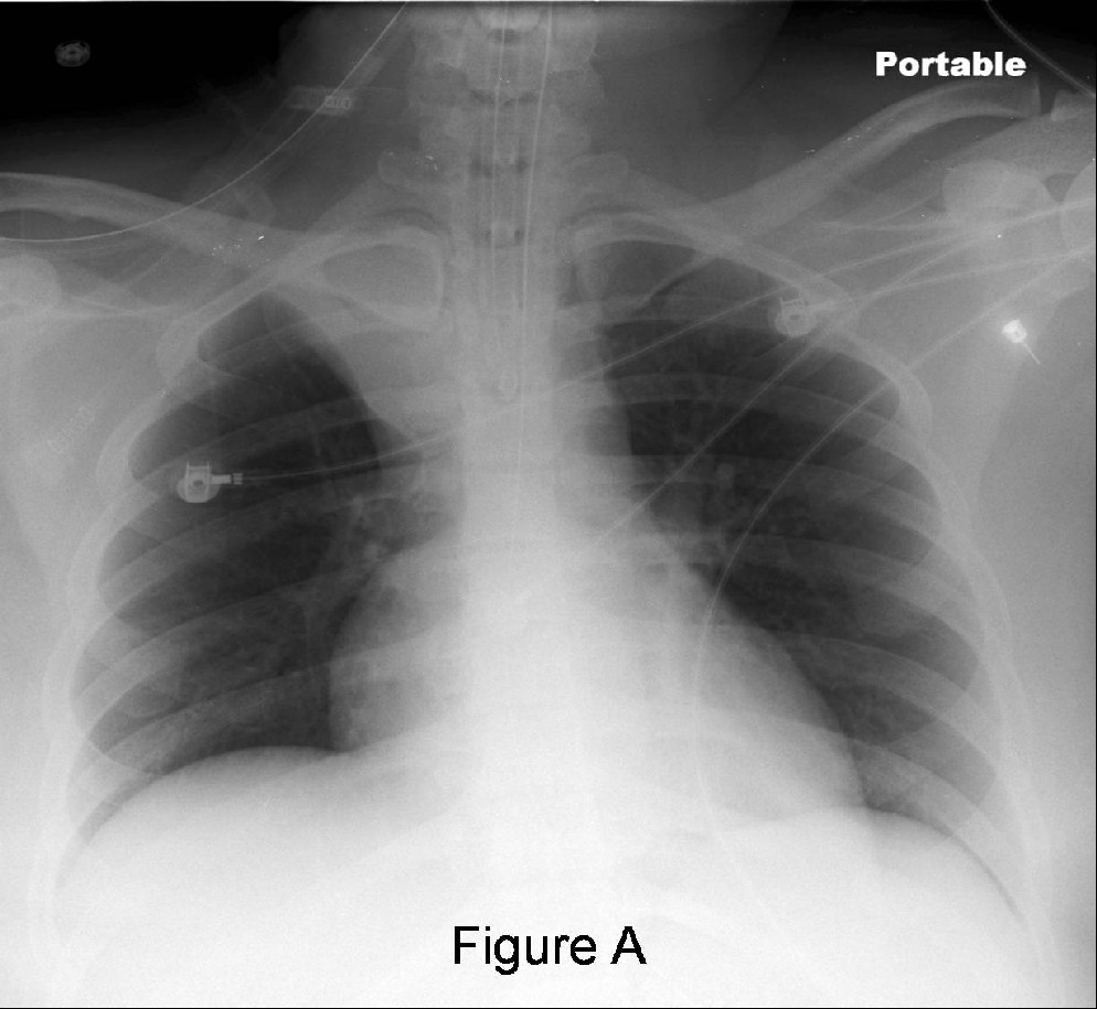 Radiograph 1 from archived case 39