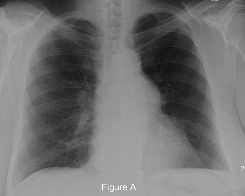 Radiograph 3 from archived case 46