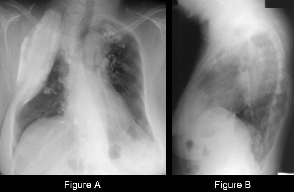 Radiograph 3 from archived case 29