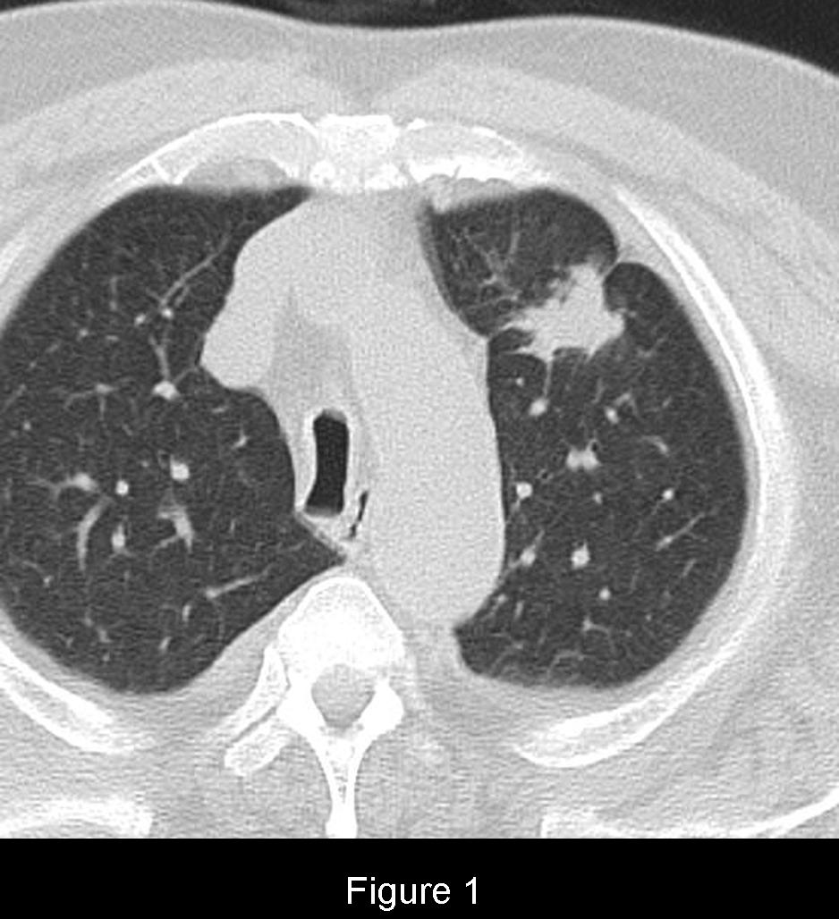 Radiograph 1 from archived case 91