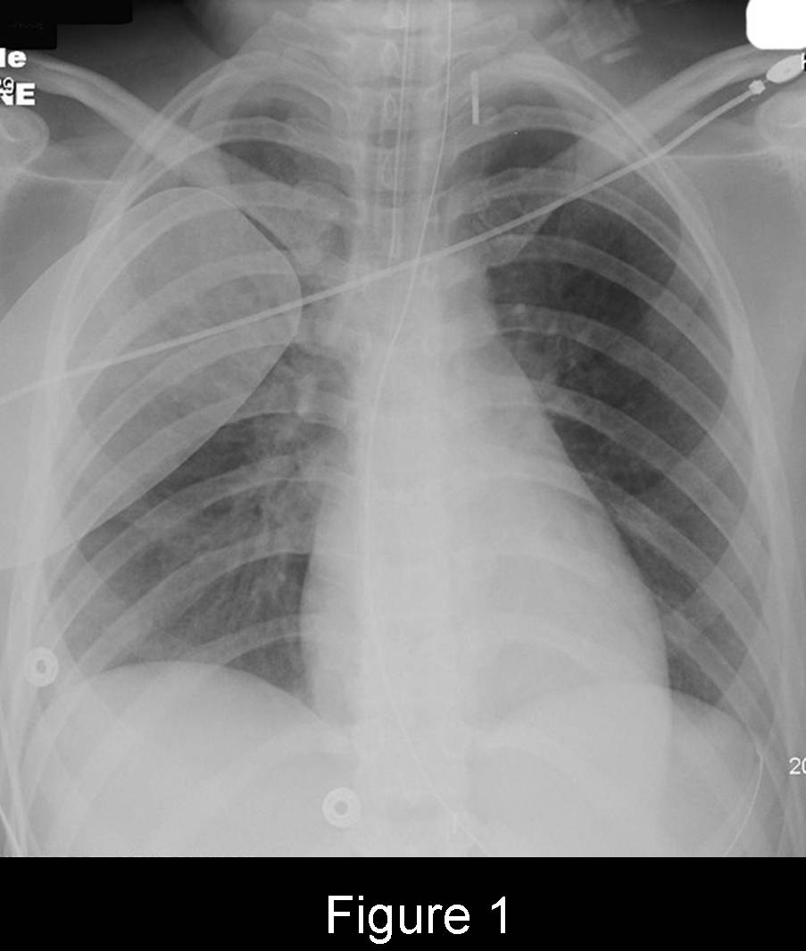 Radiograph 2 from archived case 53