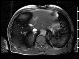 Radiograph 1 from archived case 69