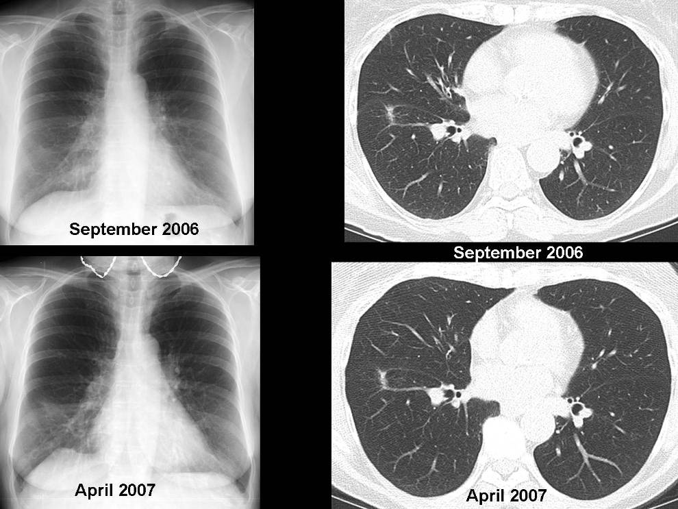 Radiograph 1 from archived case 47
