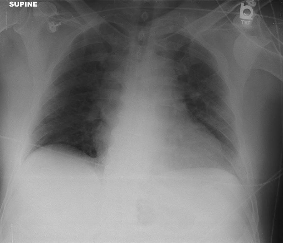 Radiograph 1 from archived case 65