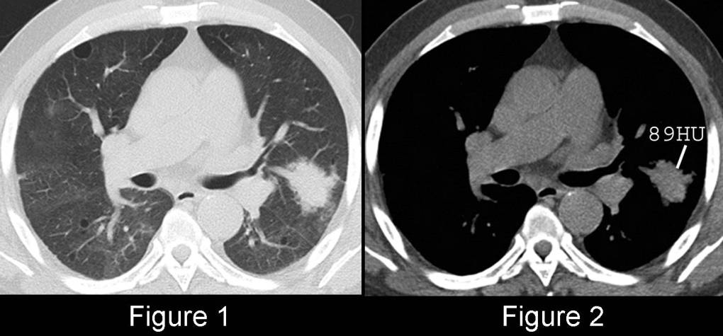 Radiograph 1 from archived case 56