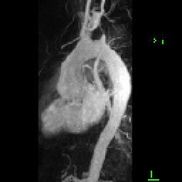 Radiograph 1 from archived case 51