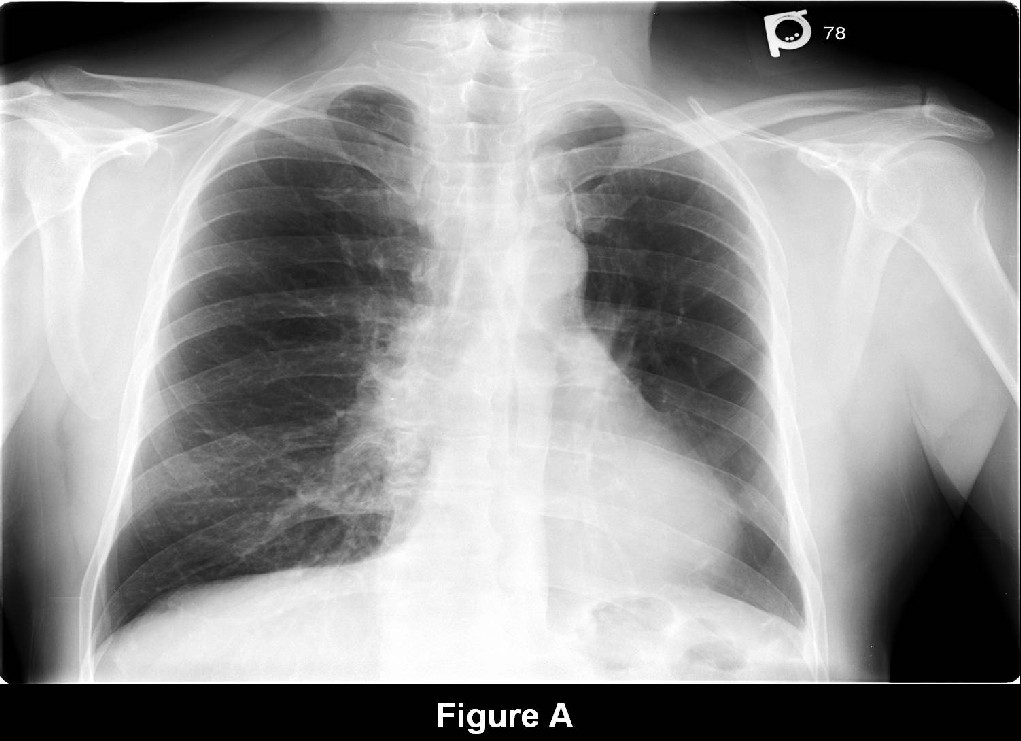 Radiograph 2 from archived case 36