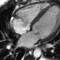 Radiograph 1 from archived case 30