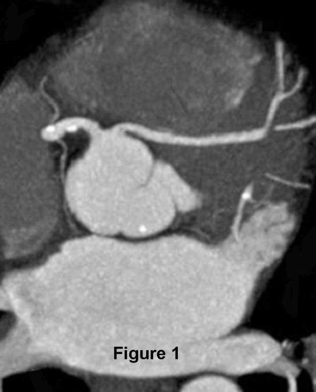 Radiograph 1 from archived case 82