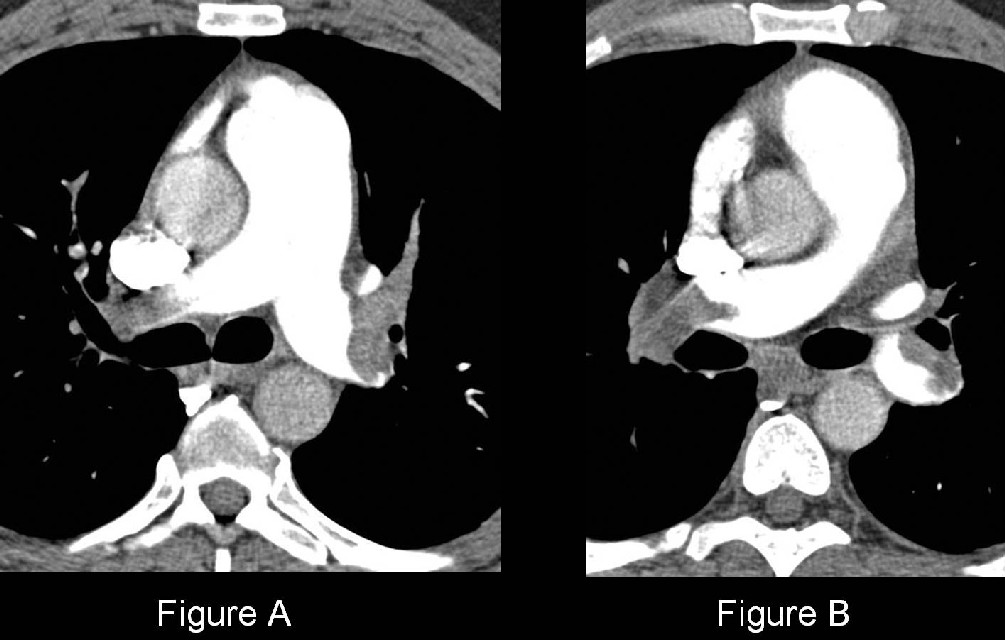 Radiograph 4 from archived case 41