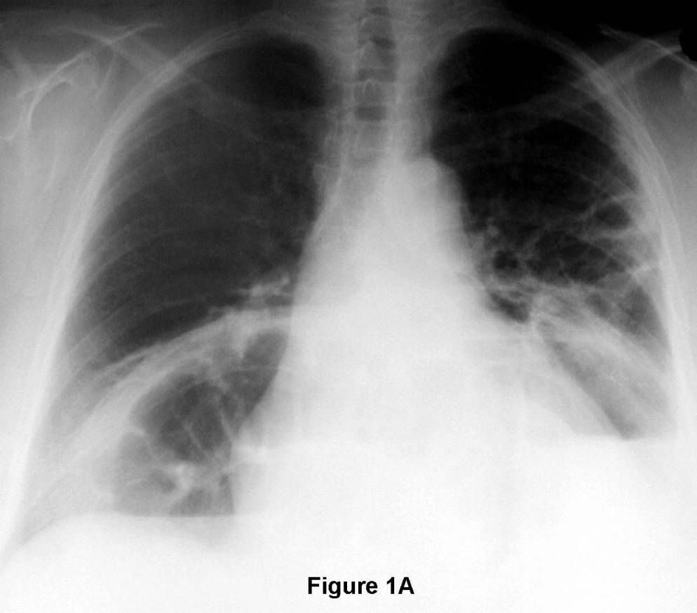 Radiograph 3 from archived case 76