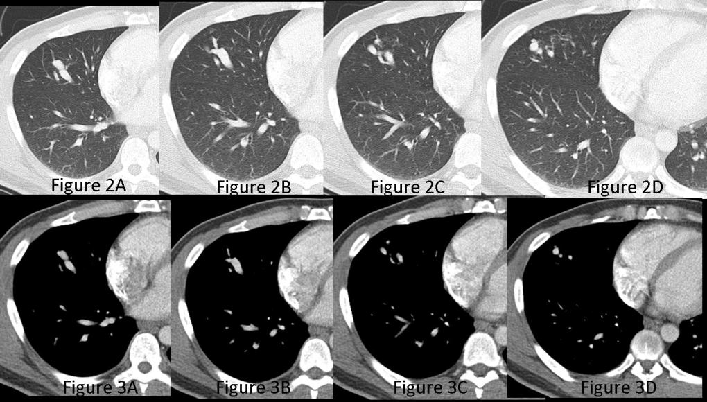 Radiograph 2 from archived case 71