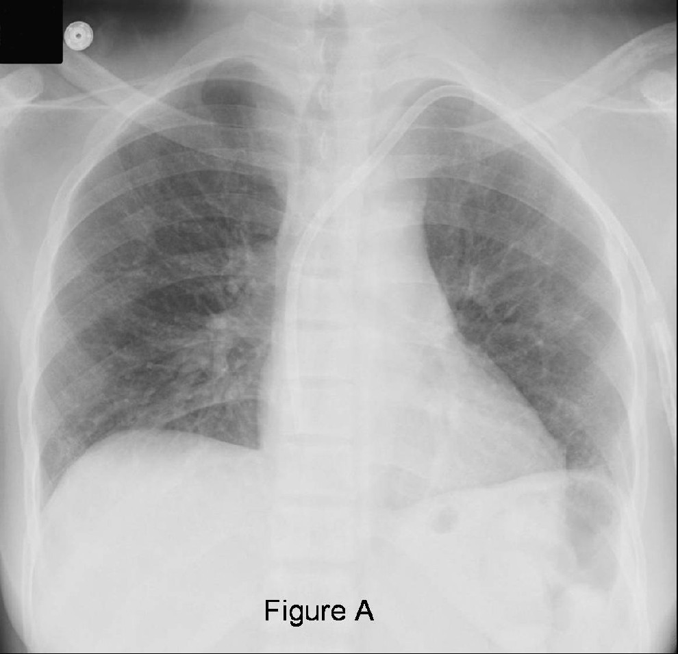 Radiograph 1 from archived case 31