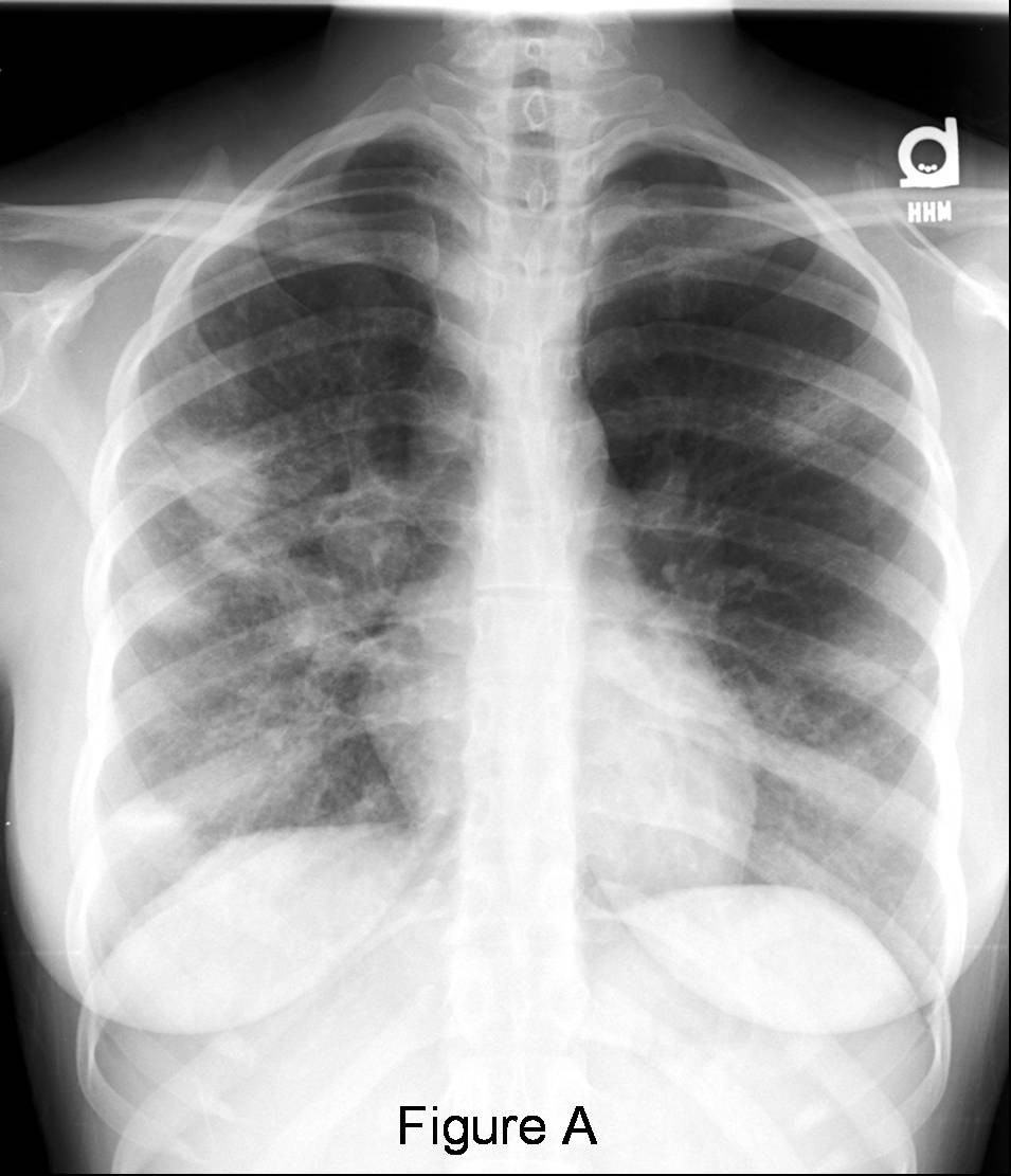 Radiograph 1 from archived case 23