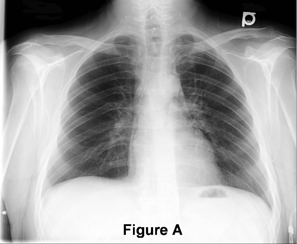 Radiograph 1 from archived case 37