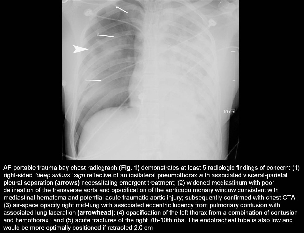 Radiograph 2 from archived case 34