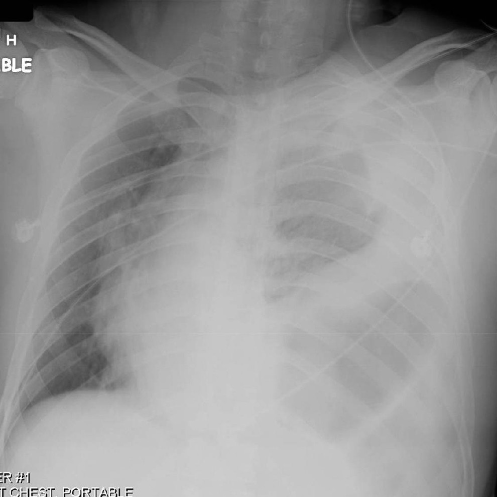 Radiograph 1 from archived case 8
