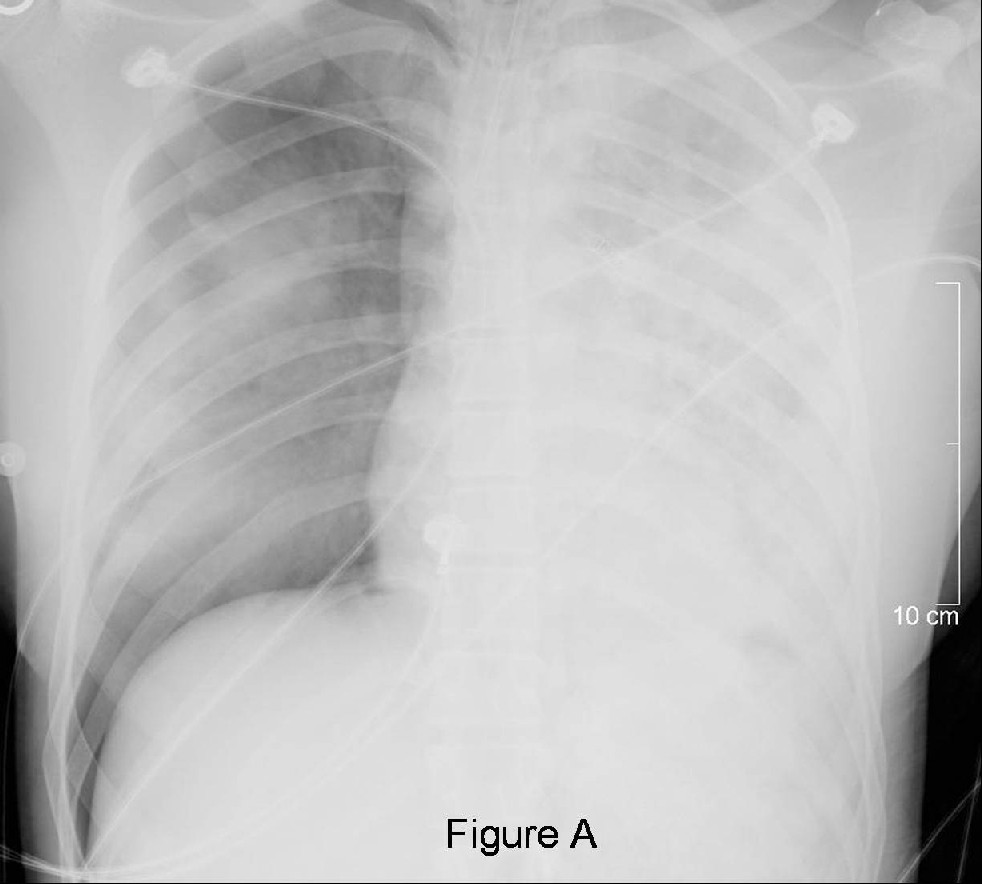 Radiograph 1 from archived case 34