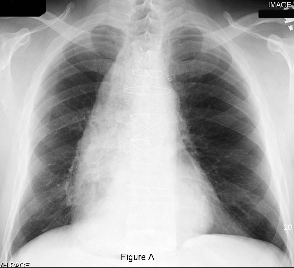 Radiograph 1 from archived case 45